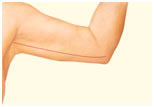 brachio-inner-arm02